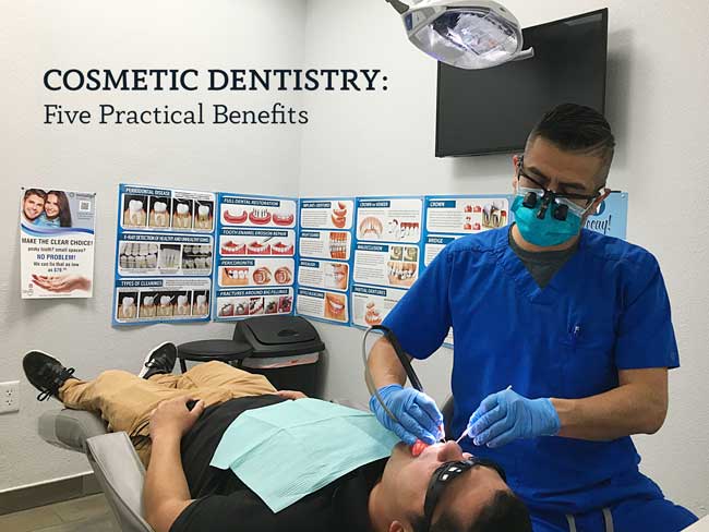 Cosmetic Dentistry in El Paso, TX | The Dentist El Paso | Benefits